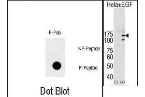 (LEFT)Dot blot analysis of Phospho-EGFR- polyclonal antibody (ABIN1881283 and ABIN2839662) on nitrocellulose membrane. (EGFR antibody  (pTyr1069))