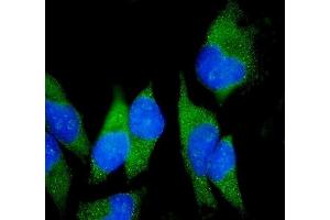 IF analysis of Claudin18/CLDN18 using anti-Claudin18/CLDN18 antibody (ABIN7601257). (Claudin 18 antibody  (AA 31-261))
