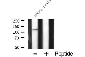 Western blot analysis of CARD6 expression in Mouse brain lysate (CARD6 antibody  (N-Term))