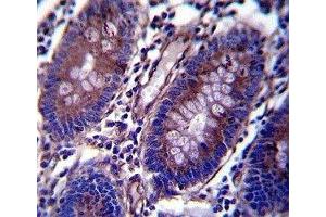 Anti-Vimentin antibody immunohistochemistry analysis in formalin fixed and paraffin embedded human colon tissue. (Vimentin antibody  (AA 430-457))