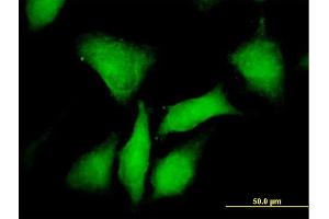 Immunofluorescence of purified MaxPab antibody to PRKAR1B on HeLa cell. (PRKAR1B antibody  (AA 1-381))