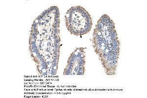 Rabbit Anti-KRT2AAntibody  Paraffin Embedded Tissue: Human Intestine Cellular Data: Epithelial cells of intestinal villas Antibody Concentration: 4. (Keratin 2 antibody  (Middle Region))