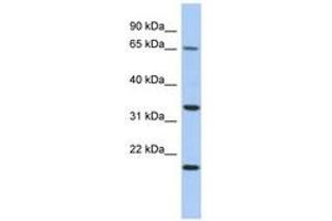 Image no. 1 for anti-Tumor Protein P63 Regulated 1 (TPRG1) (AA 35-84) antibody (ABIN6743909) (TPRG1 antibody  (AA 35-84))
