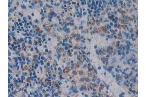 Detection of ODC in Rat Spleen Tissue using Polyclonal Antibody to Ornithine Decarboxylase (ODC) (ODC1 antibody  (AA 1-461))