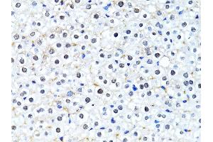 Immunohistochemistry of paraffin-embedded mouse liver using Histone H2B antibody (ABIN3015764, ABIN3015765, ABIN3015766 and ABIN6219109) at dilution of 1:100 (40x lens).