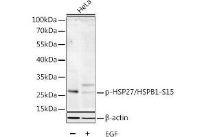Western blot analysis of extracts of HeLa cells, using Phospho-HSP27/HSPB1-S15 antibody  at 1:1000 dilution. (HSP27 antibody  (pSer15))