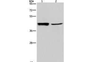 Western Blot analysis of Human hepatocellular carcinoma tissue and A549 cell using GRPR Polyclonal Antibody at dilution of 1:300 (GRPR antibody)