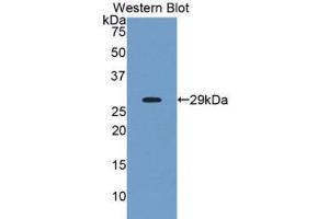 Western Blotting (WB) image for anti-Angiopoietin-Like 2 (ANGPTL2) (AA 267-493) antibody (ABIN1175210) (ANGPTL2 antibody  (AA 267-493))