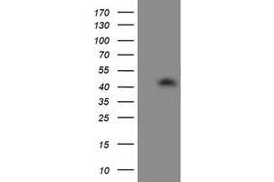 HEK293T cells were transfected with the pCMV6-ENTRY control (Left lane) or pCMV6-ENTRY ATG3 (Right lane) cDNA for 48 hrs and lysed. (ATG3 antibody)