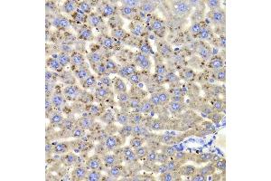 Immunohistochemistry of paraffin-embedded mouse liver using HSD17B13 Antibody. (HSD17B13 antibody  (AA 20-300))