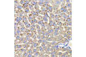 Immunohistochemistry of paraffin-embedded mouse liver using HSD17B13 Antibody.