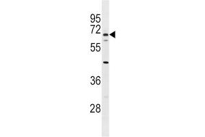 Western Blotting (WB) image for anti-Albumin (ALB) antibody (ABIN2906951)