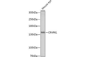 Western blot analysis of extracts of Mouse eye, using CF antibody (ABIN7266399) at 1:1000 dilution. (CFAP61 antibody)