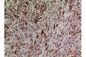 Immunohistochemistry (IHC) analysis of paraffin-embedded Human Brain, antibody was diluted at 1:100. (KEAP1 antibody  (Internal Region))
