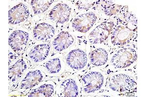 Formalin-fixed and paraffin embedded rat colon labeled with Anti-NKG2A Polyclonal Antibody, Unconjugated (ABIN739875) at 1:200 followed by conjugation to the secondary antibody (KLRC1 antibody  (AA 8-100))