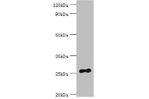 Western blot All lanes: Vesicle-associated membrane protein-associated protein B/C antibody at 3 μg/mL + Mouse brain tissue Secondary Goat polyclonal to rabbit IgG at 1/10000 dilution Predicted band size: 28, 12 kDa Observed band size: 28 kDa