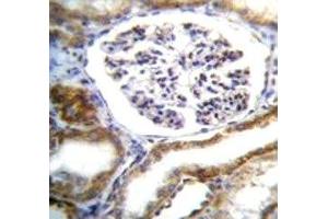 Immunohistochemistry (IHC) image for anti-Intraflagellar Transport 88 Homolog (IFT88) (AA 791-820) antibody (ABIN3028768)