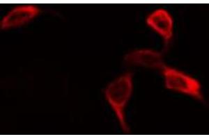 ABIN6268974 staining NIH-3T3 by IF/ICC. (EIF4B antibody  (pSer422))
