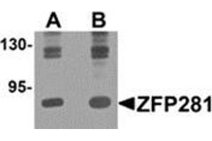 Western blot analysis of ZFP281 in A-20 cell lysate with ZFP281 antibody at (A) 0.