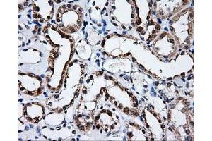 Immunohistochemical staining of paraffin-embedded prostate tissue using anti-SATB1mouse monoclonal antibody. (SATB1 antibody)