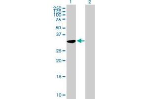 Western Blot analysis of C21orf59 expression in transfected 293T cell line by C21orf59 MaxPab polyclonal antibody. (C21orf59 antibody  (AA 1-290))