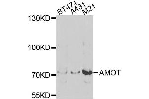 Western blot analysis of extracts of various cell lines, using AMOT antibody (ABIN5975255) at 1/1000 dilution. (Angiomotin antibody)