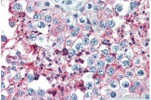 Human Testis (formalin-fixed, paraffin-embedded) stained with BSG antibody ABIN396957 at 10 ug/ml followed by biotinylated anti-mouse IgG secondary antibody ABIN481714, alkaline phosphatase-streptavidin and chromogen.