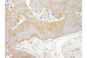 Immunohistochemistry (IHC) image for anti-eIF2 alpha/eif2s1 (C-Term) antibody (ABIN7448959) (eIF2 alpha/eif2s1 (C-Term) antibody)