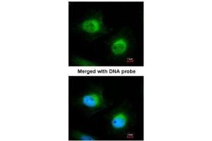 ICC/IF Image Immunofluorescence analysis of paraformaldehyde-fixed HeLa, using Cofilin 2, antibody at 1:200 dilution. (Cofilin 2 antibody  (C-Term))
