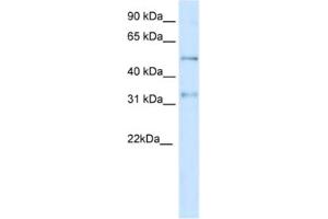 Western Blotting (WB) image for anti-Potassium Voltage-Gated Channel, Shaker-Related Subfamily, beta Member 2 (KCNAB2) antibody (ABIN2461571)