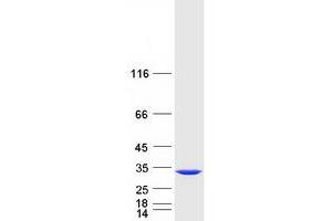 Validation with Western Blot (CYB5R2 Protein (Myc-DYKDDDDK Tag))