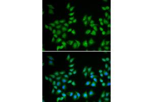 Immunofluorescence analysis of A549 cell using EIF6 antibody.