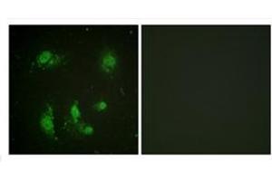 Immunofluorescence analysis of HeLa cells, using Survivin Antibody . (Survivin antibody)