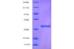SDS-PAGE (SDS) image for UDP-Gal:betaGlcNAc beta 1,4 Galactosyltransferase, Polypeptide 1 (B4GALT1) (AA 1-24) protein (GST tag) (ABIN5709113) (B4GALT1 Protein (AA 1-24) (GST tag))