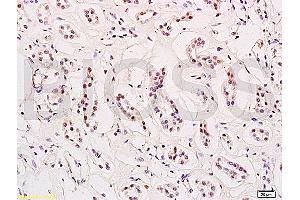 Formalin-fixed and paraffin embedded human kidney tissue labeled with Anti-HES-1 Polyclonal Antibody, Unconjugated (ABIN682393) at 1:200 followed by conjugation to the secondary antibody and DAB staining (HES1 antibody  (AA 41-150))