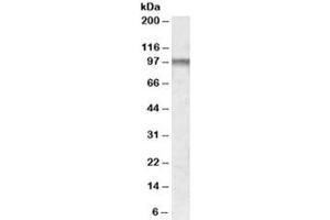 Western blot testing of human frontal cortex lysate with CPT1C antibody at 1ug/ml. (CPT1C antibody)