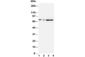 Western blot testing of PCSK9 antibody and Lane 1:  A549;  2: HeLa;  3: U87;  4: PANC cell lysate (PCSK9 antibody  (AA 671-687))