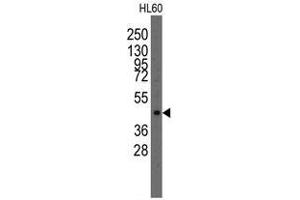 Image no. 1 for anti-LIM Homeobox Transcription Factor 1, alpha (LMX1A) (Center) antibody (ABIN356908) (LMX1A antibody  (Center))