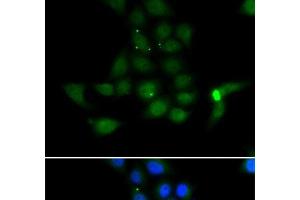 Immunofluorescence analysis of MCF-7 cells using TAT Polyclonal Antibody (Tat antibody)