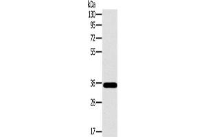 Western Blotting (WB) image for anti-OTU Domain, Ubiquitin Aldehyde Binding 1 (OTUB1) antibody (ABIN2430593) (OTUB1 antibody)