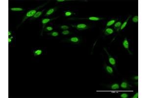 Immunofluorescence of purified MaxPab antibody to TWIST2 on HeLa cell.