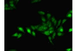 Immunofluorescent analysis of Hela cells using ABIN7153777 at dilution of 1:100 and Alexa Fluor 488-congugated AffiniPure Goat Anti-Rabbit IgG(H+L) (Geminin antibody  (AA 1-209))