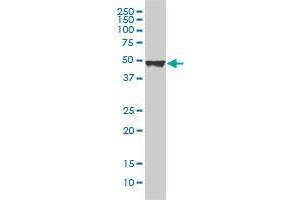 KRT20 monoclonal antibody (M01A), clone 2G3-1C8 Western Blot analysis of KRT20 expression in A-431 .