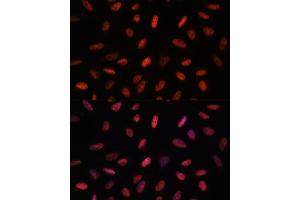 Immunofluorescence analysis of U-2 OS cells using B antibody (ABIN7265702) at dilution of 1:100. (ARID1B antibody  (AA 400-650))