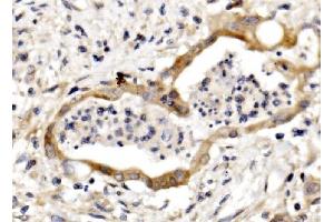 IHC analysis of Nectin 3/NECTIN3 using anti-Nectin 3/NECTIN3 antibody (ABIN7602666). (nectin-3 antibody  (AA 92-296))