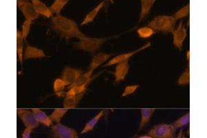 Immunofluorescence analysis of NIH-3T3 cells using UBQLN2 Polyclonal Antibody at dilution of 1:100 (40x lens). (Ubiquilin 2 antibody)
