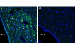 Expression of UCP2 in rat hypothalamus.