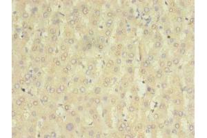 Immunohistochemistry of paraffin-embedded human liver tissue using ABIN7155881 at dilution of 1:100 (HOMER2 antibody  (AA 1-343))
