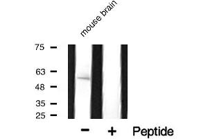 Western blot analysis of Cytochrome P450 17A1 expression in mouse tissue.
