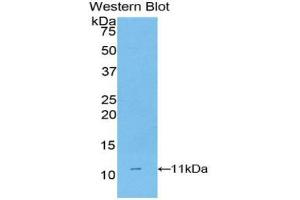 Western blot analysis of the recombinant protein. (CD3D antibody  (AA 22-106))